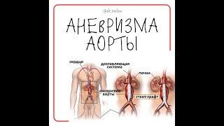 Эндопротезирование аневризмы брюшного отдела аорты на УЗИ