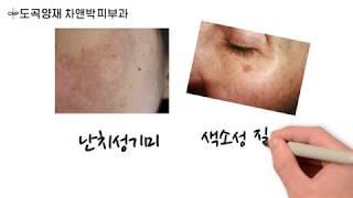 차앤박피부과 도곡양재의 인기시술!레이저스태킹 후관리 방법??