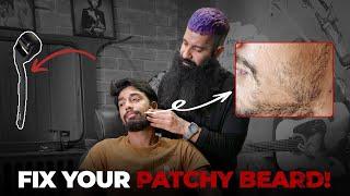 How To Fix Patchy Beard | Patchy Beard Hacks | Beard Growth | Grooming Masterclass EP 2