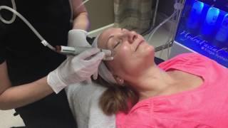 What is a HydraFacial MD Treatment & Why Do You Need One?