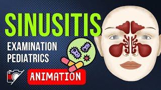 WHAT IS RHINO - SINUSITIS ? | Pediatrics | Anatomy | Development | Definitions | Animation