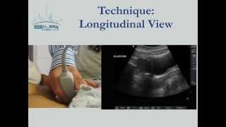 First Trimester Pregnancy Ultrasound