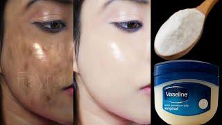 Put Vaseline and Baking Powder You Won't Believe the Results I Regrett I Didn't Know It Long Time