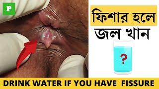 Drink Water If You Have Anal Fissure | Simplest Home Remedy without Surgery | 100% Result |Tripura