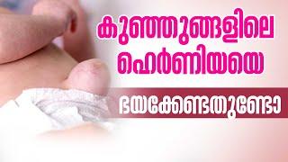 കുട്ടികളിലെ ഹെർണിയക്ക് ചികിത്സ എങ്ങനെ? | Pediatric Hernia | Hernia In Children | Health