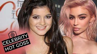 Celebrities Before and After Plastic Surgery | Celebrity Hot Goss