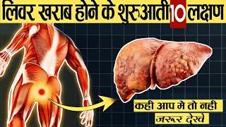 लिवर खराब होने के शुरुआती 10 लक्षण | 10 weird sings of liver damage | Liver Damage Sign in Hindi