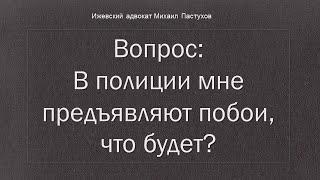 Иж Адвокат Пастухов. Вопрос: В полиции мне предъявляют побои, что будет?