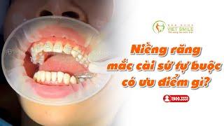 Niềng răng mắc cài sứ tự động có ưu điểm gì?