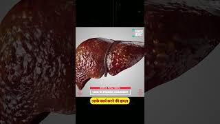 थकान और कमजोरी अगर ये 10 लक्षण नजर आएं , तो तुरंत | 10 Early Signs of Liver Damage