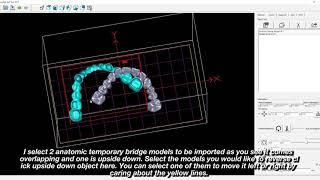 DentaFab Nesting and Support for Temporary Design