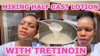 MIXING HALF CAST LOTION WITH TRETINOIN? TRIED THIS YET ?