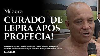 CURADO DE LEPRA APÓS PROFECIA!