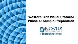 Western Blot Visual Protocol: Phase 1: Sample Preparation