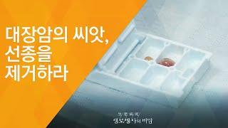 대장암의 씨앗, 선종을 제거하라 - (2017.6.7_623회 방송)_발병률 1위, 대장암을 극복하라