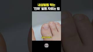[전문가 발톱 공개] 내성발톱 안 생기게 자르는 정확한 방법