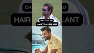 Cricketers who have undergone Hair transplant.