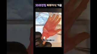 이식이 필요한 신체부위를 3D프린팅하는 기술 #columbiauniversity #피부이식 #생체공학