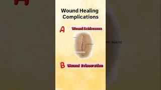 Wound Healing Complications #woundhealing #aiims #aiimsdelhi #norcetmcq #norcet8 #norcet2025 #nurse