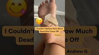 Is This Foot Peel Mask Safe? | Satisfying Peeling Process #footcare #footpeeling #shorts #feet #peel