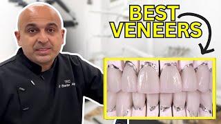 THESE ARE THE BEST VENEERS!  Dr Aleem Shows Off TKC Veneers