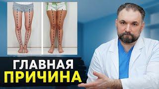 Перестань ЭТО делать! Причина появления О и Х образных ног!