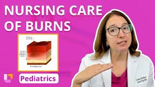 Nursing Care of Burns: Alterations in Health - Pediatric Nursing, Integumentary System | @LevelUpRN