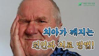 치아가 깨지는 원인과 치료 방법 평택치과 소사벌 바른이턱치과에서 알려드립니다