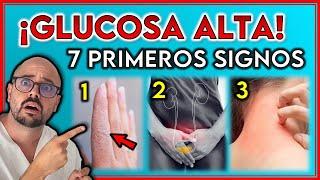 7 SEÑALES REVELADORAS de una DIABETES IRREVERSIBLE || ¡SIGNOS de GLUCOSA ALTA!