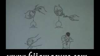 Different types of Hijama by hijamacups com Part 2