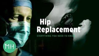 Hip Replacement - Everything you need to know