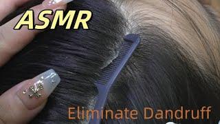 ASMR-I cleared away all the snowflakes on my head.