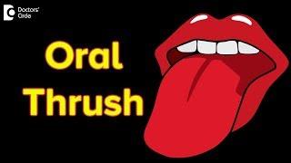 Oral thrush: Causes, Symptoms, Treatment | Oral thrush contagious