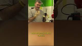 Клипсы OTSC: лайфхаки от эксперта #эндоскопия #доктор #лечениежкт