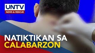 Apat na bagong kaso ng mpox, naitala sa Calabarzon – DOH