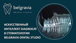  Искусственный интеллект Диагнокат в стоматологии Belgravia Dental Studio