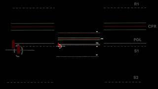 Selling Strategy in Options @Trade2cpr #stockmarket  #trading  #options