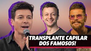 Esses famosos passaram por um transplante capilar | Celebridades | VIX Icons