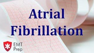 Atrial Fibrillation ECG - EMTprep.com
