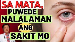 Sa Mata, Puwede Malalaman ang Sakit Mo. - By Doc Willie Ong (Internist and Cardiologist)