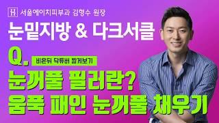 [김형수눈밑지방] 눈꺼풀 필러? 움푹 패인 눈꺼풀 채우기 - 서울에이치피부과