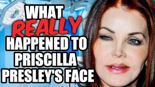 PRISCILLA PRESLEY: Shattered Beauty | The TRUE Tragic Ending of Elvis' Ex-Wife: BOTCHED SURGERY!