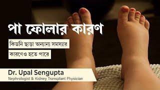 পা ফুলে যাওয়ার কারণ কারণ ও প্রতিকার | Causes for swollen legs and feet or Edema in Bengali