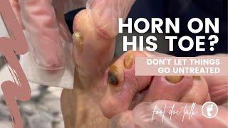 Horn on His Toe!