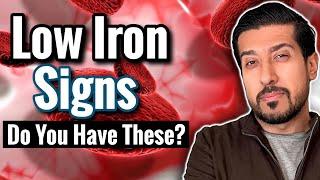 7 SIGNS of Iron Deficiency to Catch Now | Iron Deficiency Without Anemia