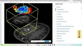 NeuroCavePlus immersive visual exploration BraTS mpMRI data with Tumor Connectome Framework analysis