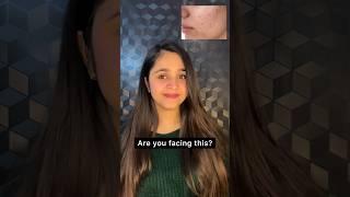 Are you facing skin dullness or hairfall? Try these Purna gummies Link in description #ytshorts