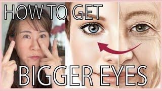 MAKE EYES BIGGER BY DOING THIS!Lift sagging eye lids, erase eye bags, dark circles. Permanently!