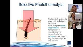 Lynton Lasers Free Webinar  Introduction to Hair Removal with LASER & IPL