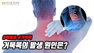 [바디올 한의원] 거북목이 발생하는 원인은 무엇인가│거북목